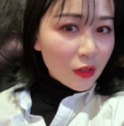 去重庆好美找李曾显做了埋线提升手术40天