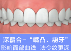 成年以后，还可以做牙齿矫正吗?有必要吗?