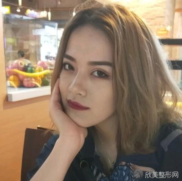 重庆华美医院潘宝华下颌角案例分享,前后效果对比