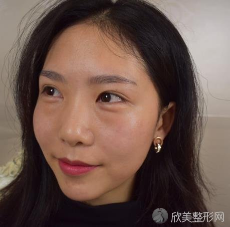 深圳市人民医院整形外科去眼袋价格如何？案例+价格表分享