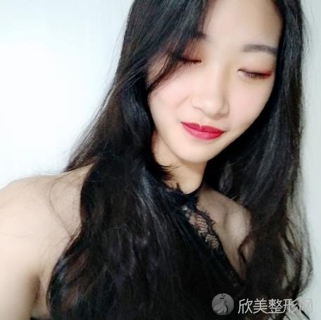 北京达美如艺国海军医生吸脂到底好不好？-看吸脂术前术后素颜对比效果如何