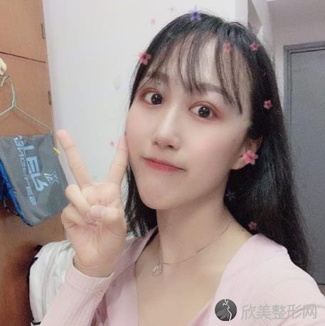 上海华美杨亚益做眼睛修复怎么样?附案例恢复效果+口碑价格一览