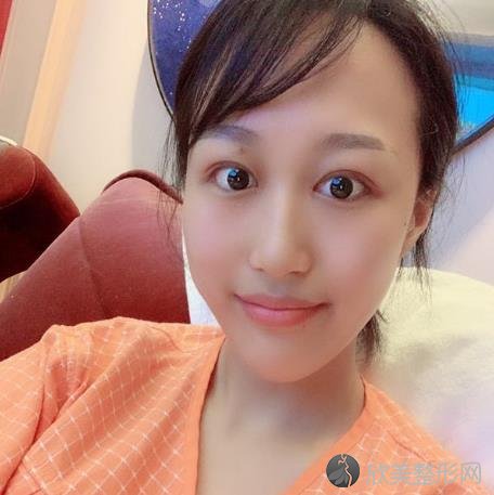 上海华美杨亚益做眼睛修复怎么样?附案例恢复效果+口碑价格一览