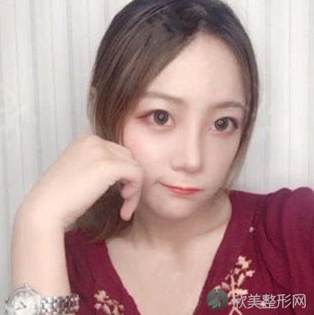 北京丰台医院整形美容科项目价格表！附隆鼻术后恢复经历和效果图