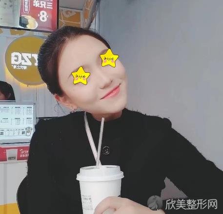 南京美莱赵其中鼻修复技术怎么样呢？来看看案例术后恢复照片就知道了