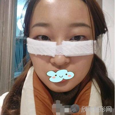 兰州军区陆军总院整形美容中心去眼袋究竟怎么样呢？内附案例，效果对比图分