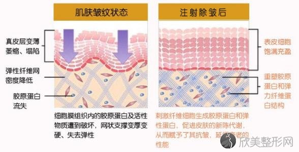 福田庆三医生科普面部除皱