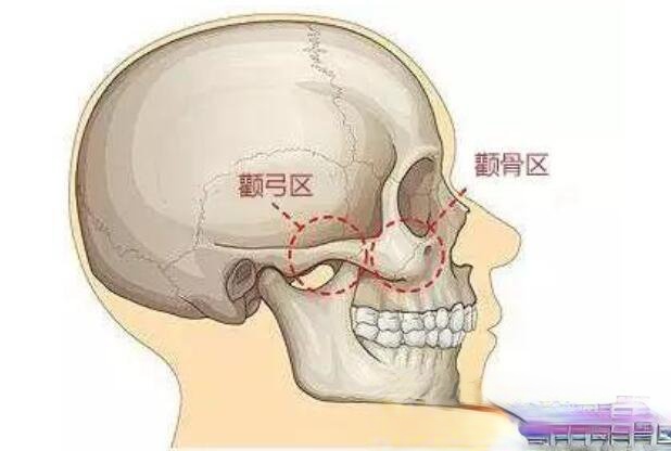 上海九院做颧骨技术怎么样？附真实案例