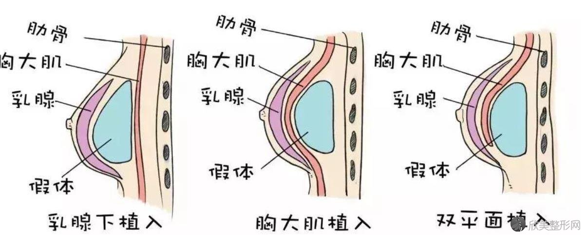 北京东方和谐和八大处隆胸哪个好,口碑技术对比