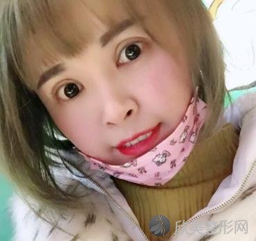 杭州绽美整形医院怎么样？内附双眼皮案例分享以及价格表