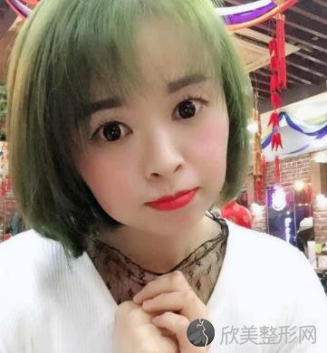 杭州绽美整形医院怎么样？内附双眼皮案例分享以及价格表