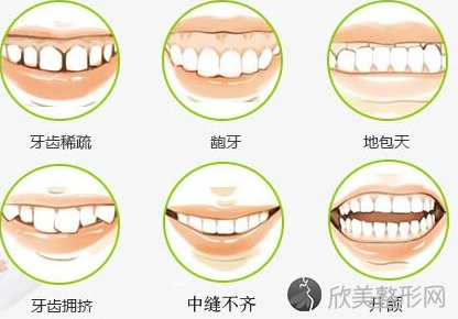 牙齿矫正