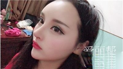 重庆美仑美奂整形美容怎么样？附案例-价格表一览