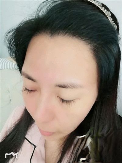 长沙丽都整形美容医院正规吗？医院案例-项目价格表较新