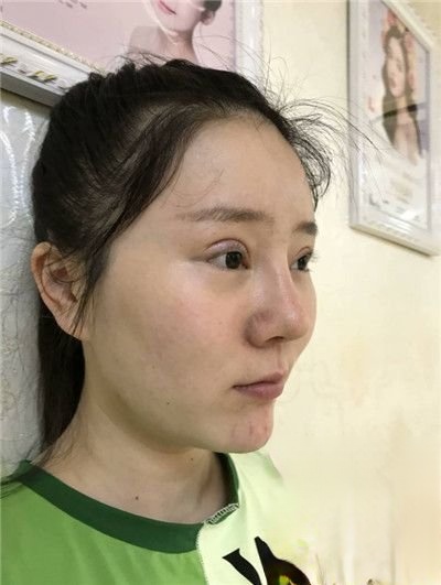 长沙美之峰医疗美容门诊部怎么样？医院案例-项目价格表较新