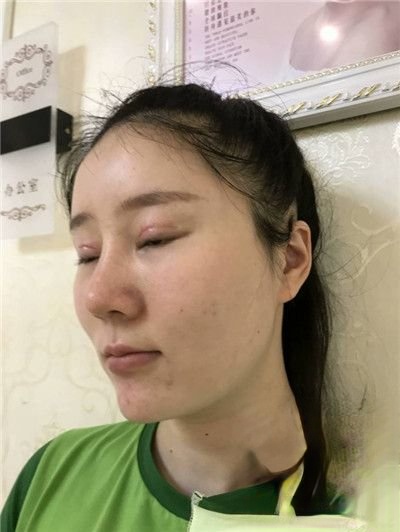 长沙美之峰医疗美容门诊部怎么样？医院案例-项目价格表较新