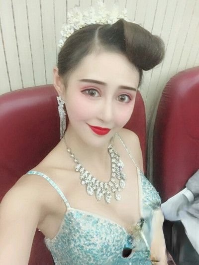 重庆华美整形美容医院祛斑怎么样？附案例-全新价格表