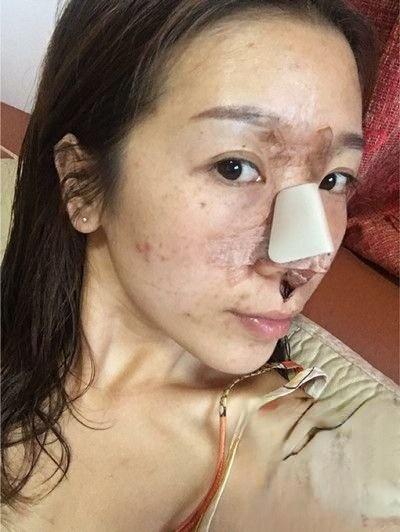 重庆华美整形口碑怎么样？医院案例-项目价格表较新