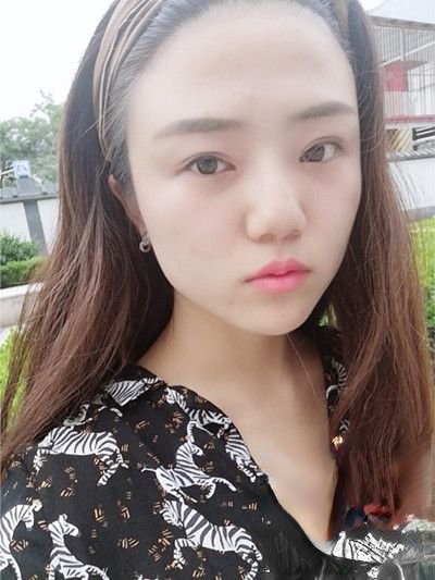 重庆华美整形美容医院怎么样？附案例-全新价格表