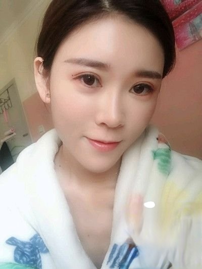 合肥徽媛美整形医院怎么样？自体脂肪填充面部案例-项目价格表较新