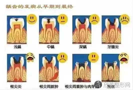 牙齿上的小黑点到恶化要多久呀？