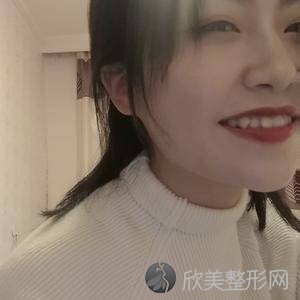 海南哪家医院做V-line瓜子脸比较靠谱？排名前四权威医美口碑盘点-含手术价格