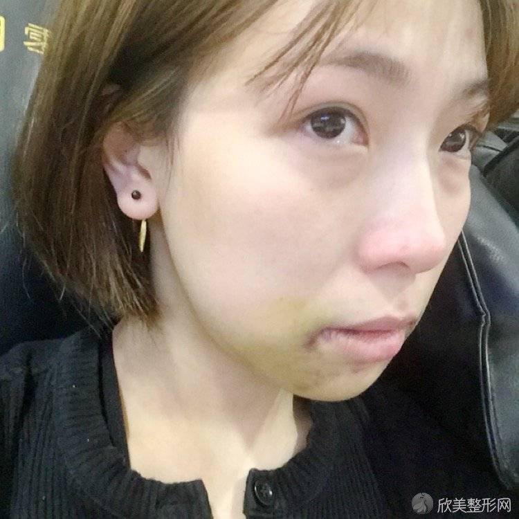 盐城曼丽莎医疗美容门诊部宋昌奉做牙齿矫正怎么样？附医生简介-牙齿矫正案