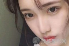 曲靖美莱注射隆鼻好不好？