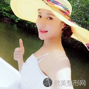 哈尔滨成美医疗美容门诊部陈国良做双眼皮怎么样？附医生简介-韩式双眼