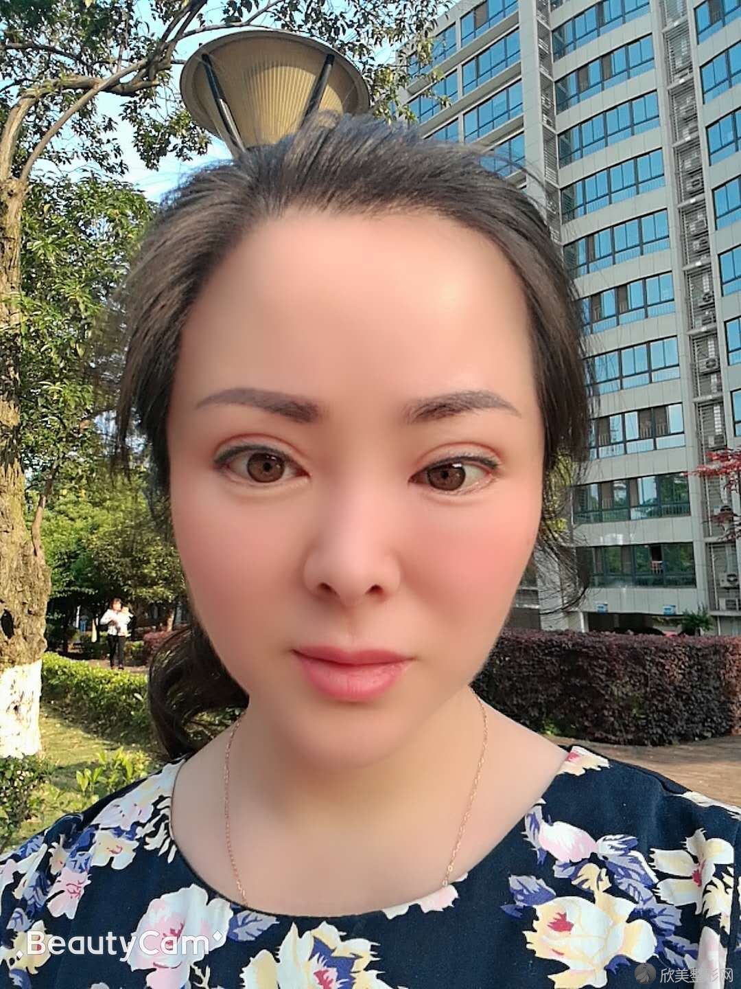 历下熙美人医疗美容门诊部董泗洋做脂肪填充面部怎么样？附医生简介-脂肪填