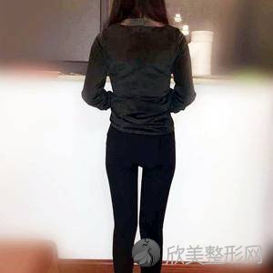 盘锦卉妮整形美容何怀万做吸脂瘦腰怎么样？附医生简介-吸脂瘦腰案例及价格