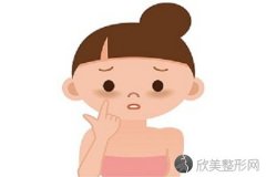 激光去除黑眼圈好吗