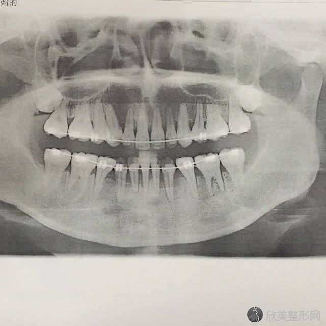 金华八大口腔医院盘点前三排行榜!星之地、UC江南、横店文荣医院都在内!！