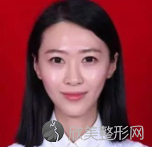 包头第四医院整形美容科姜琰做吸脂瘦大腿怎么样？附医生简介-吸脂瘦大腿案