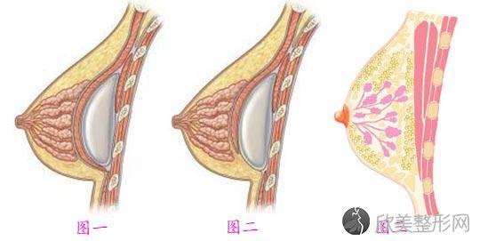 苏州自体脂肪隆胸会有风险吗