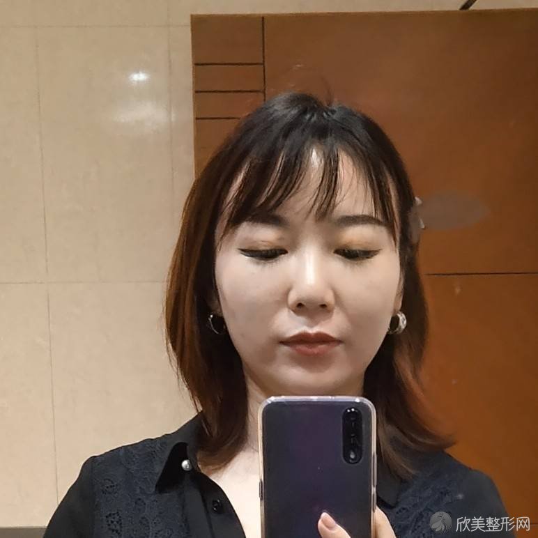 厦门思明美莱整形医疗美容医院张少军做吸脂瘦脸怎么样？附医生简介-吸脂瘦