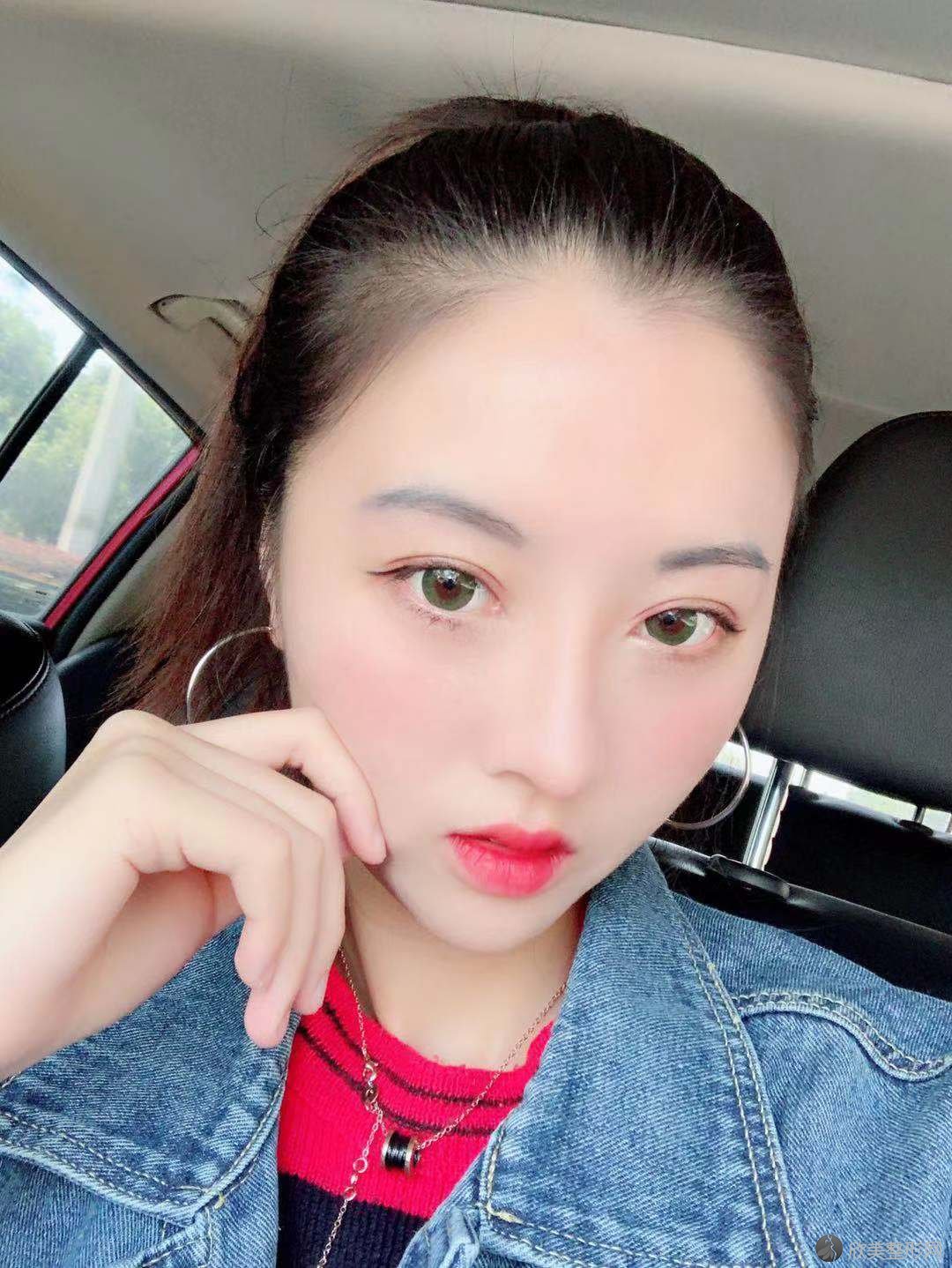 徐州哪家医院做硅胶丰太阳穴比较好？云龙区美玲、同康中医门诊、赫美等实力