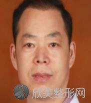 上海时光整形医院李桂海做假体隆胸怎么样？附医生简介-假体隆胸案例及价格