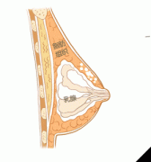 广州做自体脂肪隆胸是否会留下疤痕呢