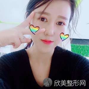 绵阳哪家医院做自体软骨垫鼻尖效果比价好？排名前三华美紫馨、城区金点、晞