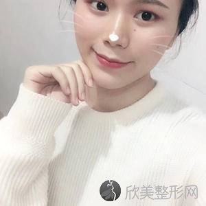 阜阳黛莱美整形医院李继伟做超声波洁牙怎么样？附医生简介-超声波洁牙案例