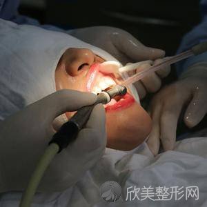 新出一份新疆十大公立和私立口腔排名及口腔价目表