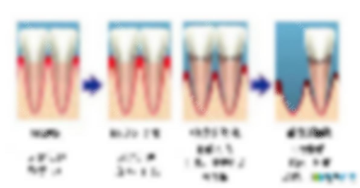 黑三角能恢复正畸吗？牙龈萎缩是黑三角的真正原因