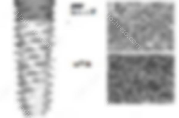 韩国奥牙泰种植牙的质量如何？一颗牙多少钱？