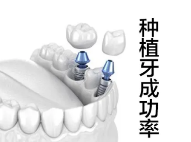 科普：瑞典Astra种植体适不适合年轻人？有什么特点和优势？