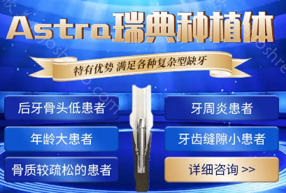 科普：瑞典Astra种植体适不适合年轻人？有什么特点和优势？