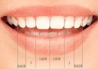 自测你的牙齿到底长得标不标准，整齐的牙齿标准图你确定不看？