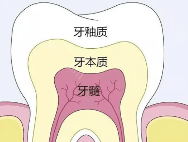 牙釉质其实可以慢慢修复是真的吗?良心牙医告诉你