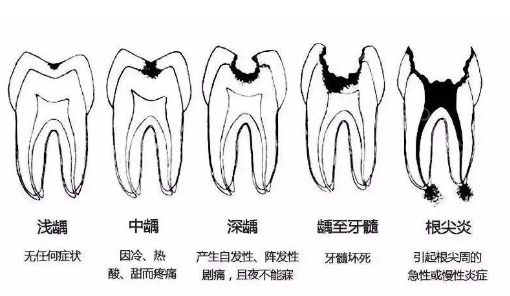 分享我在成都补牙的经验，再也不用去找哪家好了！