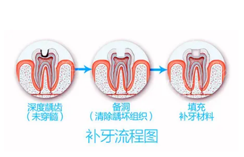 避坑指南,哈尔滨补牙齿哪家医院好?这里都是看牙还实惠的牙科！